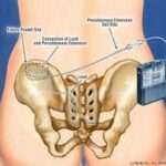 Pelvic Floor Clinic